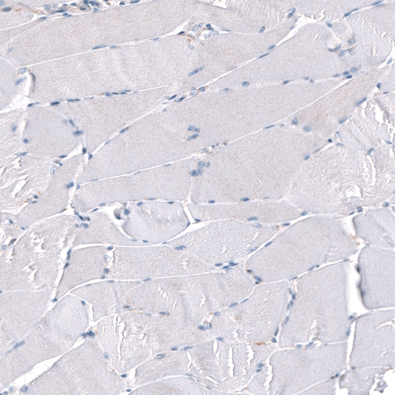 Periostin/OSF-2 Antibody (CL12087) - Azide and BSA Free Immunohistochemistry-Paraffin: Periostin/OSF-2 Antibody [NBP3-44358]