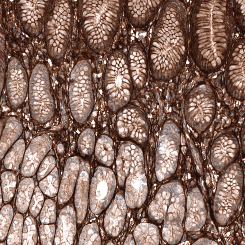 Periostin/OSF-2 Antibody (CL12087) - Azide and BSA Free Immunohistochemistry-Paraffin: Periostin/OSF-2 Antibody [NBP3-44358]