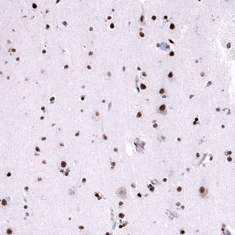 FoxM1 Antibody (CL12131) - Azide and BSA Free Immunohistochemistry-Paraffin: FoxM1 Antibody [NBP3-44359]