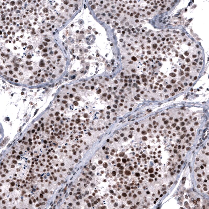 FoxM1 Antibody (CL12131) - Azide and BSA Free Immunohistochemistry-Paraffin: FoxM1 Antibody [NBP3-44359]