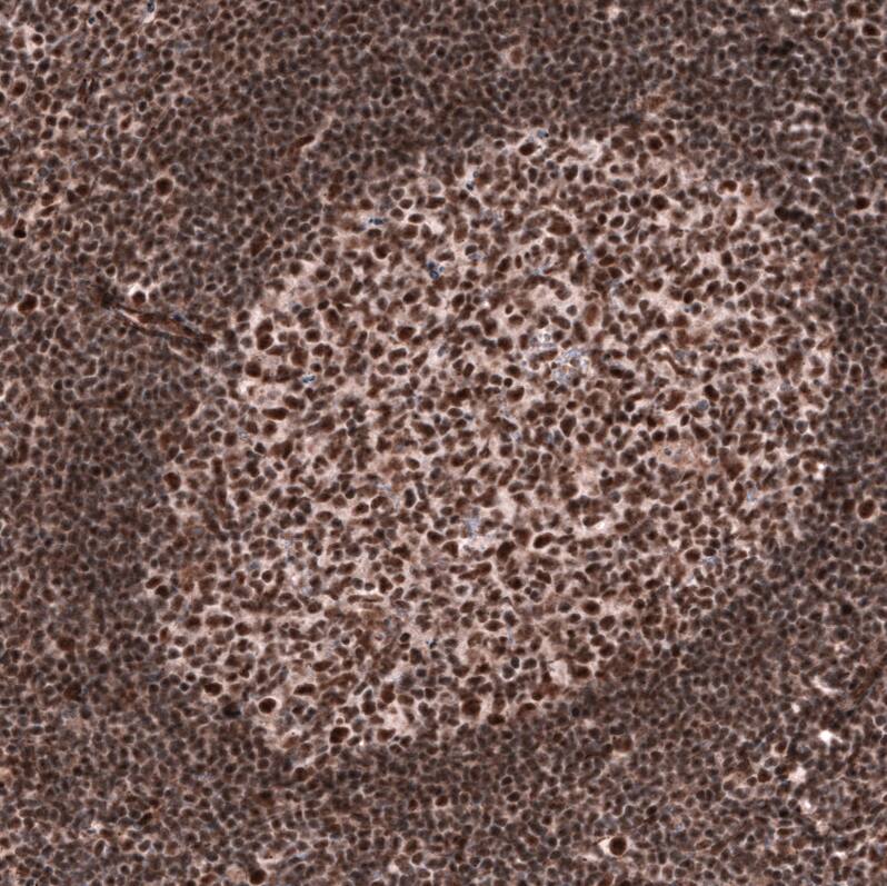 FoxM1 Antibody (CL12131) - Azide and BSA Free Immunohistochemistry-Paraffin: FoxM1 Antibody [NBP3-44359]