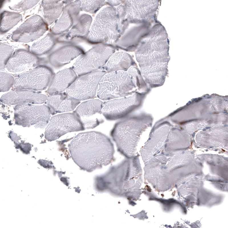 Chitinase 3-like 1/YKL-40 Antibody (CL12314) - Azide and BSA Free Immunohistochemistry-Paraffin: Chitinase 3-like 1/YKL-40 Antibody [NBP3-44361]