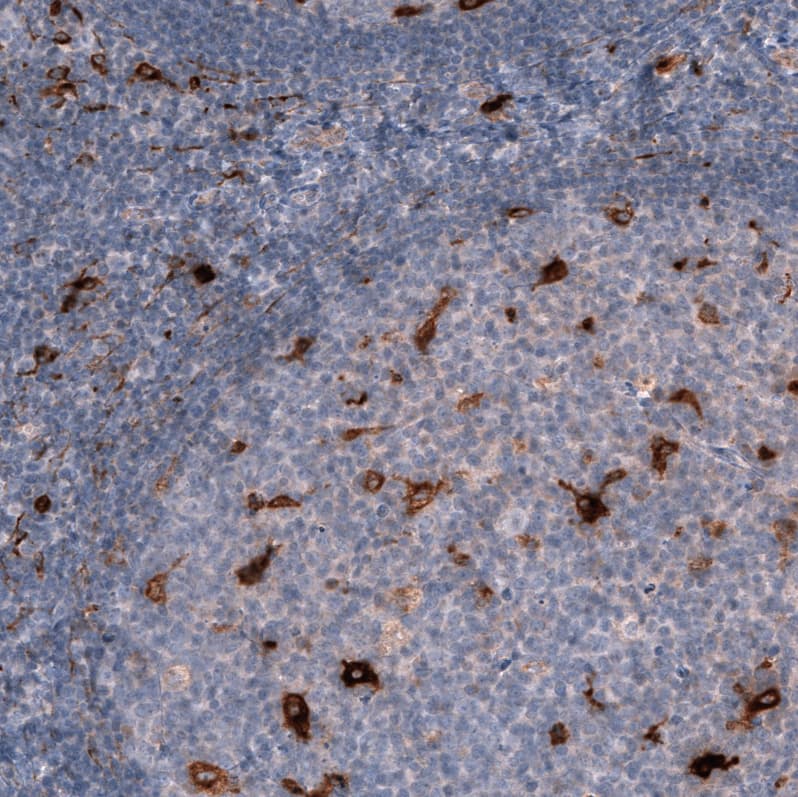 Chitinase 3-like 1/YKL-40 Antibody (CL12314) - Azide and BSA Free Immunohistochemistry-Paraffin: Chitinase 3-like 1/YKL-40 Antibody [NBP3-44361]