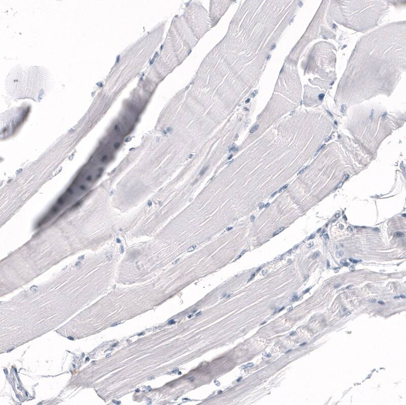 CD5 Antibody (CL12334) - Azide and BSA Free Immunohistochemistry-Paraffin: CD5 Antibody [NBP3-44362]