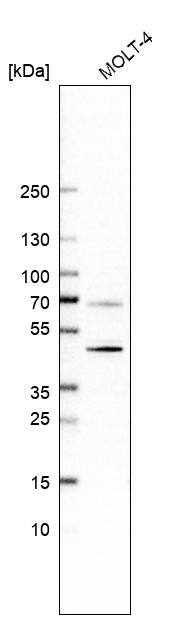 CD5 Antibody (CL12334) - Azide and BSA Free Western Blot: CD5 Antibody [NBP3-44362]
