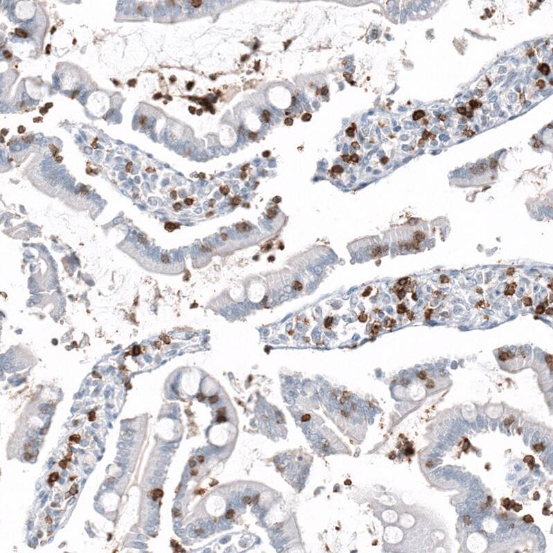 CD5 Antibody (CL12334) - Azide and BSA Free Immunohistochemistry-Paraffin: CD5 Antibody [NBP3-44362]