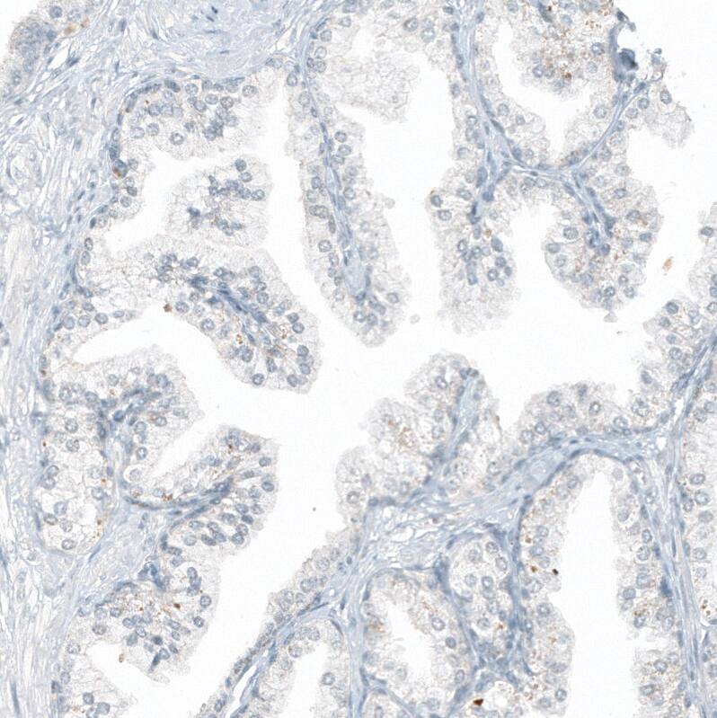 CD23/Fc epsilon RII Antibody (CL12435) - Azide and BSA Free Immunohistochemistry-Paraffin: CD23/Fc epsilon RII Antibody [NBP3-44363]