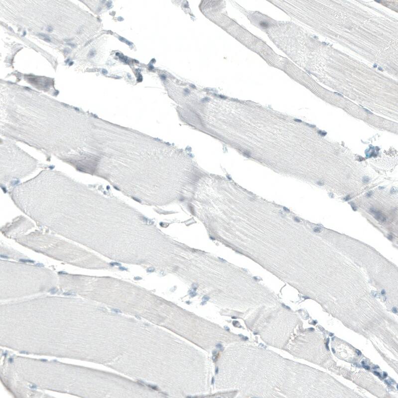 CD23/Fc epsilon RII Antibody (CL12435) - Azide and BSA Free Immunohistochemistry-Paraffin: CD23/Fc epsilon RII Antibody [NBP3-44363]