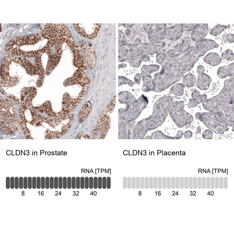 Claudin-3 Antibody (CL13130) - Azide and BSA Free Immunohistochemistry-Paraffin: Claudin-3 Antibody [NBP3-44366]