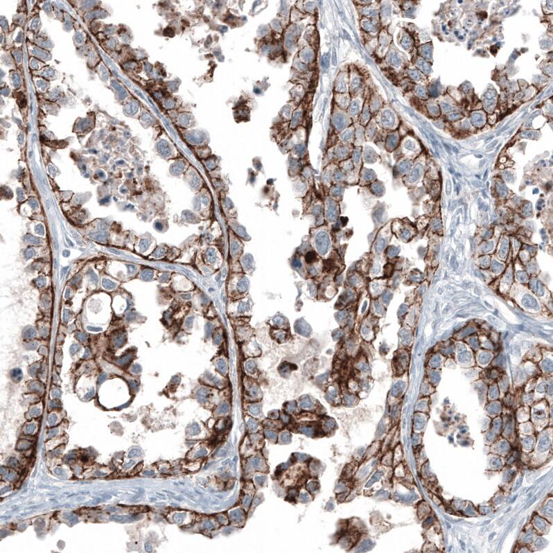 Claudin-3 Antibody (CL13130) - Azide and BSA Free Immunohistochemistry-Paraffin: Claudin-3 Antibody [NBP3-44366]