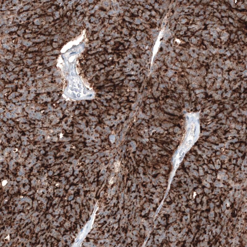 Claudin-3 Antibody (CL13129) - Azide and BSA Free Immunohistochemistry-Paraffin: Claudin-3 Antibody [NBP3-44367]
