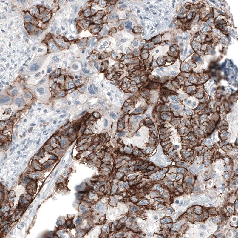 Claudin-3 Antibody (CL13129) - Azide and BSA Free Immunohistochemistry-Paraffin: Claudin-3 Antibody [NBP3-44367]