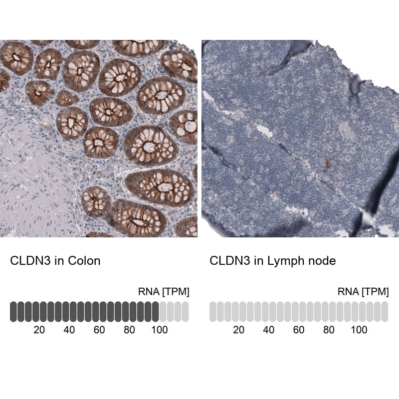 Claudin-3 Antibody (CL13128) - Azide and BSA Free Immunohistochemistry-Paraffin: Claudin-3 Antibody [NBP3-44368]