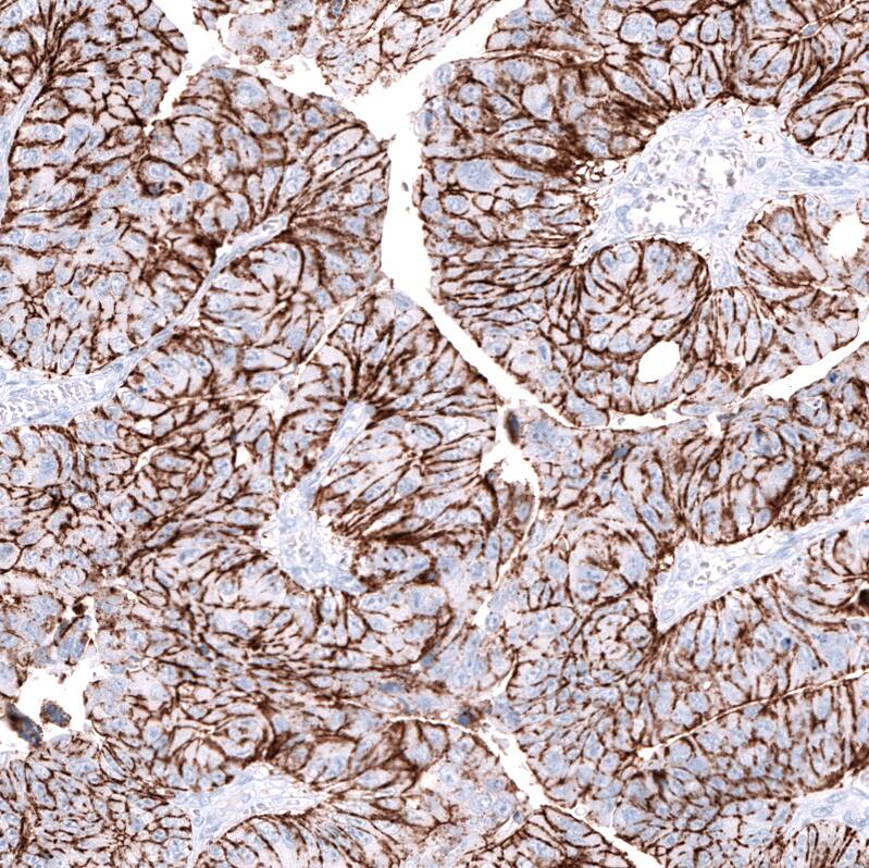 Claudin-3 Antibody (CL13128) - Azide and BSA Free Immunohistochemistry-Paraffin: Claudin-3 Antibody [NBP3-44368]