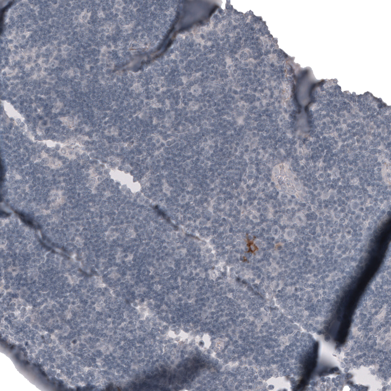 Claudin-3 Antibody (CL13128) - Azide and BSA Free Immunohistochemistry-Paraffin: Claudin-3 Antibody [NBP3-44368]