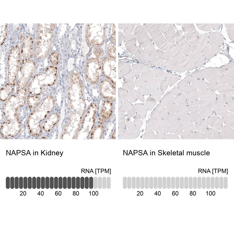 Napsin A Antibody (CL12954) - Azide and BSA Free Immunohistochemistry-Paraffin: Napsin A Antibody [NBP3-44369]