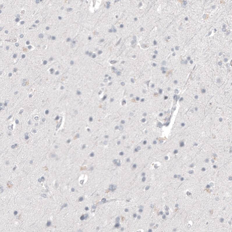 Napsin A Antibody (CL12954) - Azide and BSA Free Immunohistochemistry-Paraffin: Napsin A Antibody [NBP3-44369]