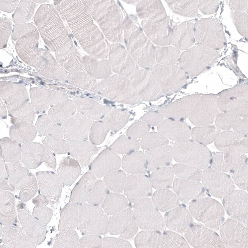 Napsin A Antibody (CL12954) - Azide and BSA Free Immunohistochemistry-Paraffin: Napsin A Antibody [NBP3-44369]