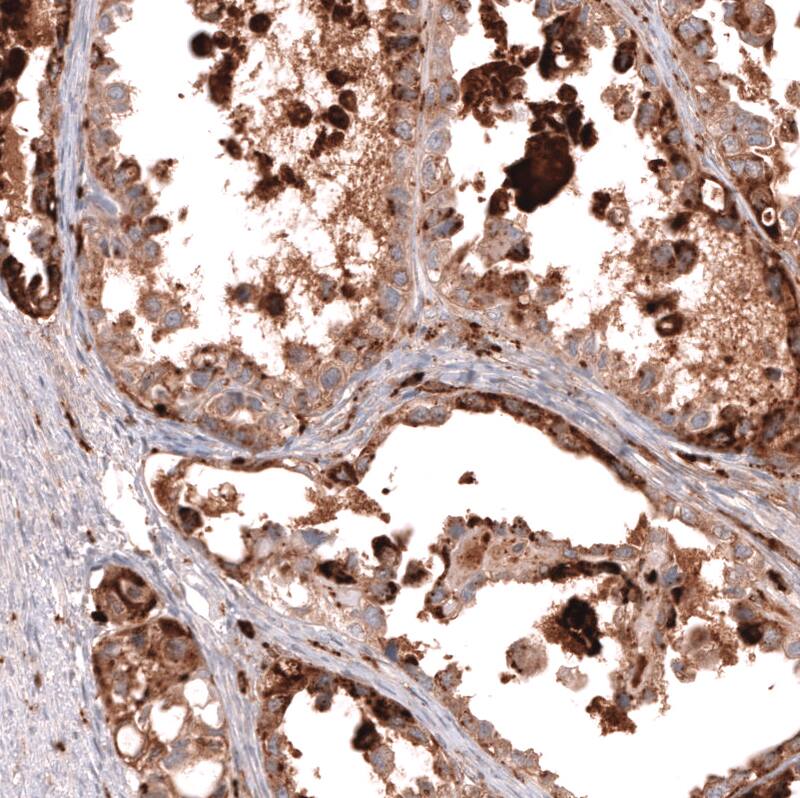 Napsin A Antibody (CL12954) - Azide and BSA Free Immunohistochemistry-Paraffin: Napsin A Antibody [NBP3-44369]