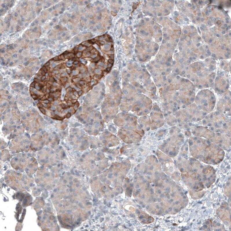 CD99 Antibody (CL12929) - Azide and BSA Free Immunohistochemistry-Paraffin: CD99 Antibody [NBP3-44371]
