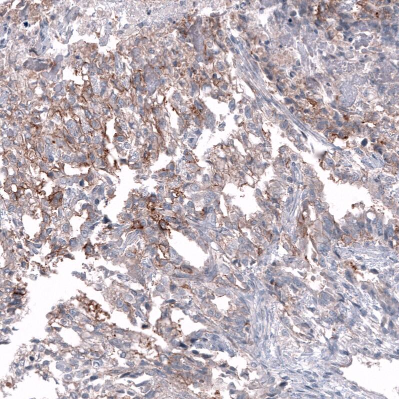 CD99 Antibody (CL12929) - Azide and BSA Free Immunohistochemistry-Paraffin: CD99 Antibody [NBP3-44371]