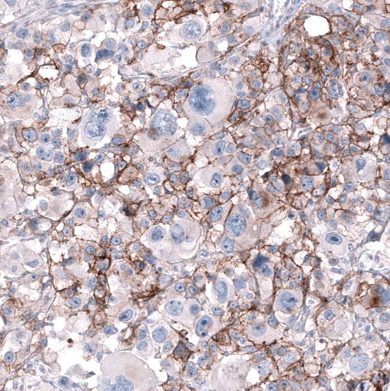 CD99 Antibody (CL12929) - Azide and BSA Free Immunohistochemistry-Paraffin: CD99 Antibody [NBP3-44371]