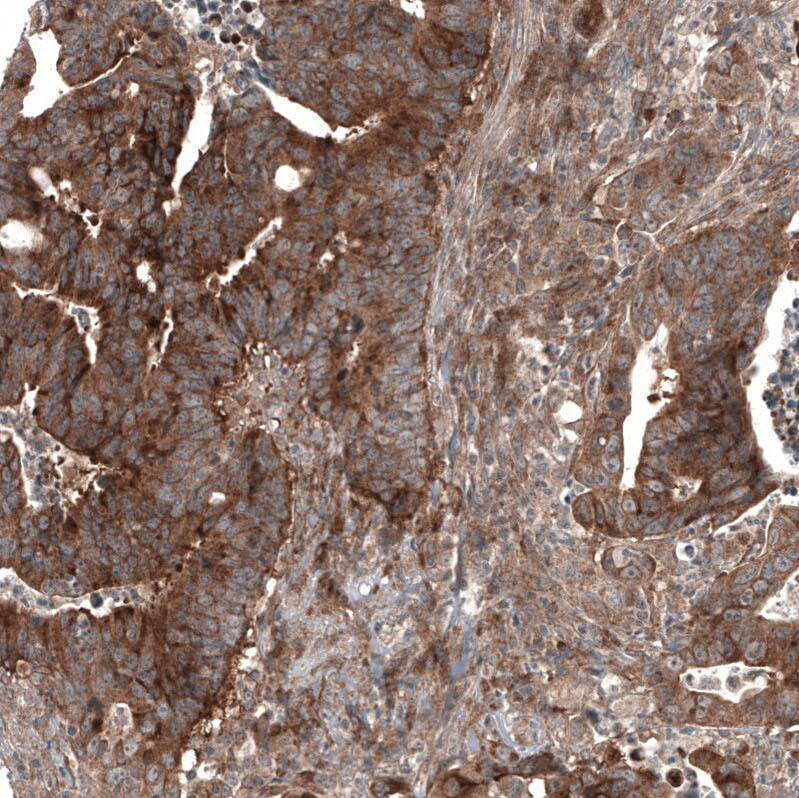 GSPT1 Antibody (CL13336) - Azide and BSA Free Immunohistochemistry-Paraffin: GSPT1 Antibody [NBP3-44372]