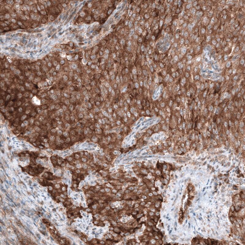 GSPT1 Antibody (CL13336) - Azide and BSA Free Immunohistochemistry-Paraffin: GSPT1 Antibody [NBP3-44372]