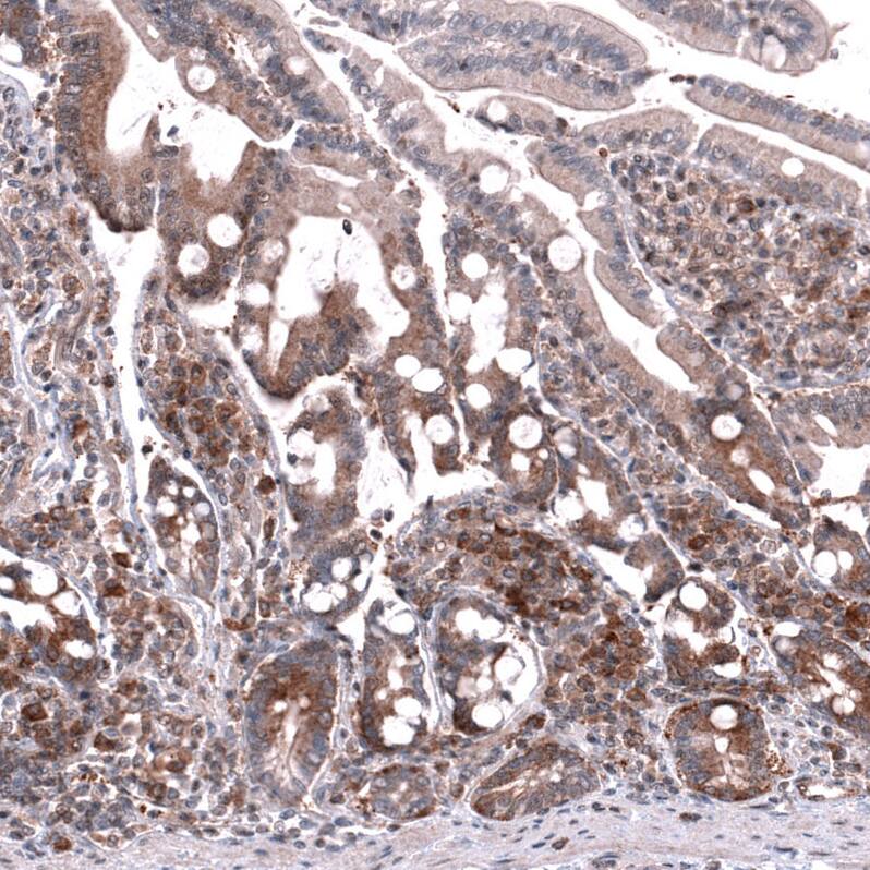 GSPT1 Antibody (CL13336) - Azide and BSA Free Immunohistochemistry-Paraffin: GSPT1 Antibody [NBP3-44372]