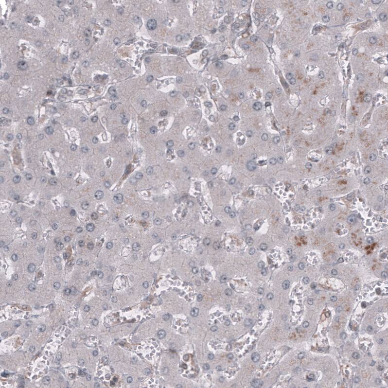 GSPT1 Antibody (CL13336) - Azide and BSA Free Immunohistochemistry-Paraffin: GSPT1 Antibody [NBP3-44372]