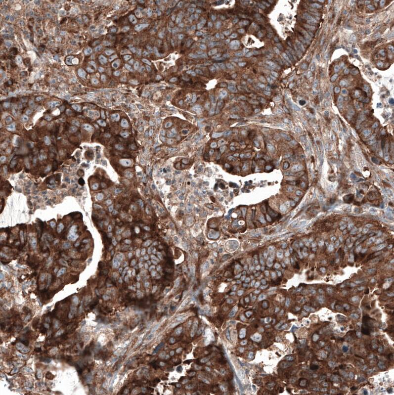 GSPT1 Antibody (CL13332) - Azide and BSA Free Immunohistochemistry-Paraffin: GSPT1 Antibody [NBP3-44373]