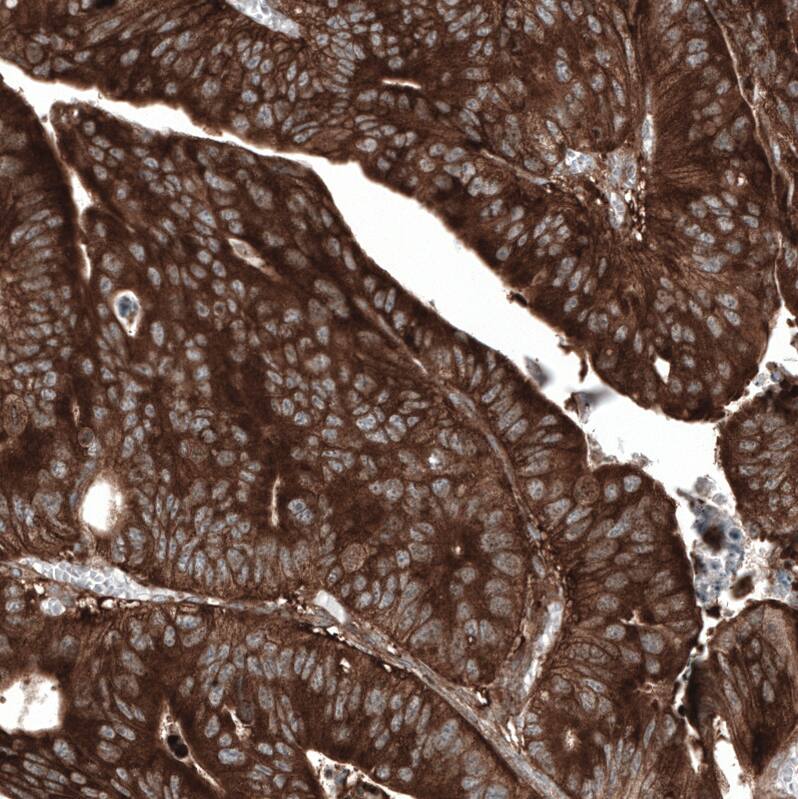 GSPT1 Antibody (CL13332) - Azide and BSA Free Immunohistochemistry-Paraffin: GSPT1 Antibody [NBP3-44373]