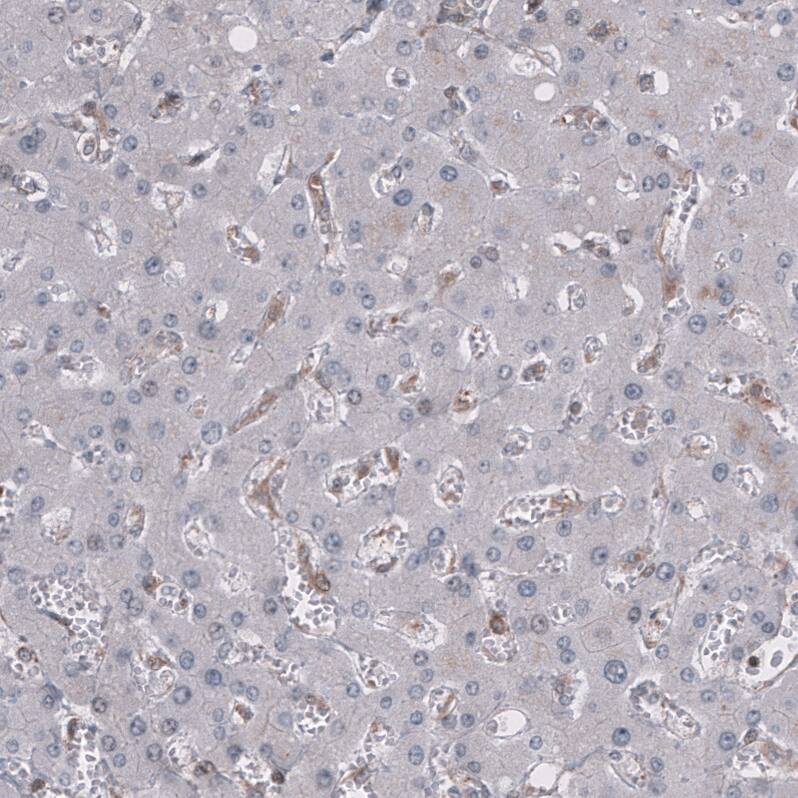 GSPT1 Antibody (CL13332) - Azide and BSA Free Immunohistochemistry-Paraffin: GSPT1 Antibody [NBP3-44373]