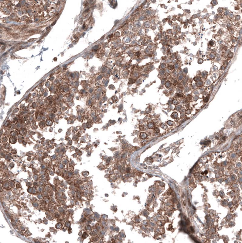 GSPT1 Antibody (CL13332) - Azide and BSA Free Immunohistochemistry-Paraffin: GSPT1 Antibody [NBP3-44373]