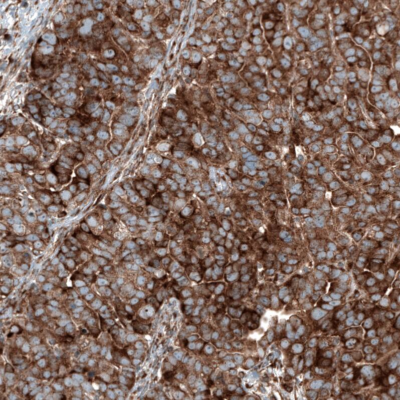 GSPT1 Antibody (CL13332) - Azide and BSA Free Immunohistochemistry-Paraffin: GSPT1 Antibody [NBP3-44373]