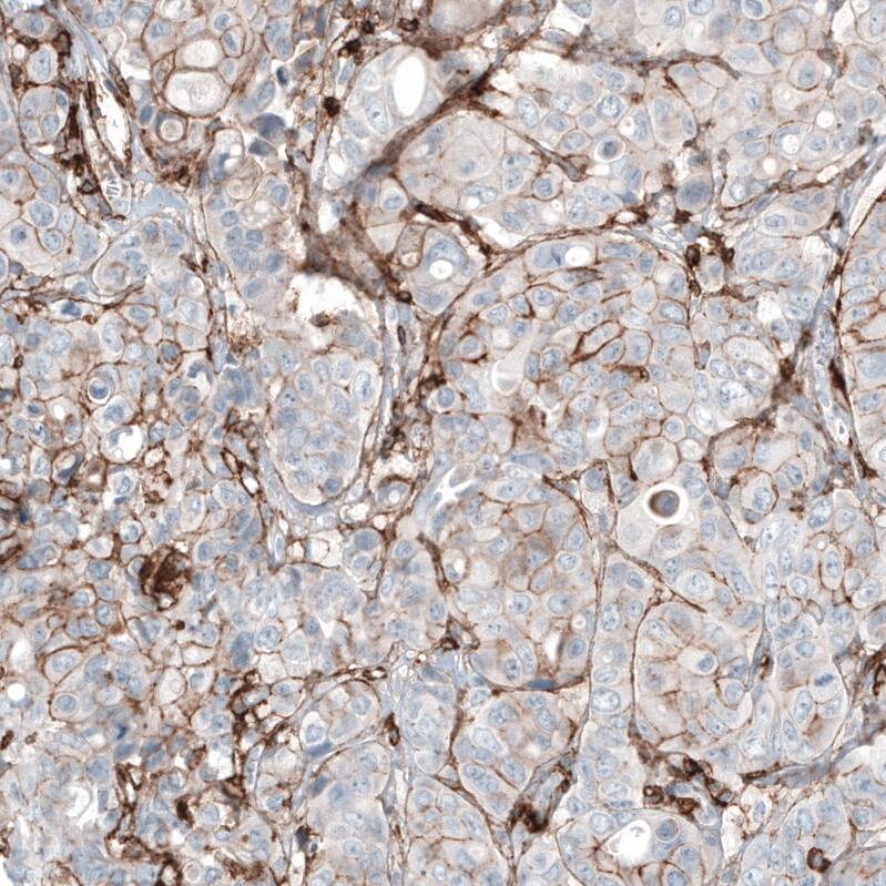CD44 Antibody (CL13328) - Azide and BSA Free Immunohistochemistry-Paraffin: CD44 Antibody [NBP3-44374]