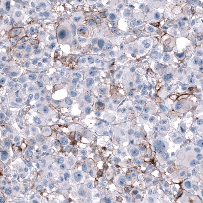 CD44 Antibody (CL13328) - Azide and BSA Free Immunohistochemistry-Paraffin: CD44 Antibody [NBP3-44374]
