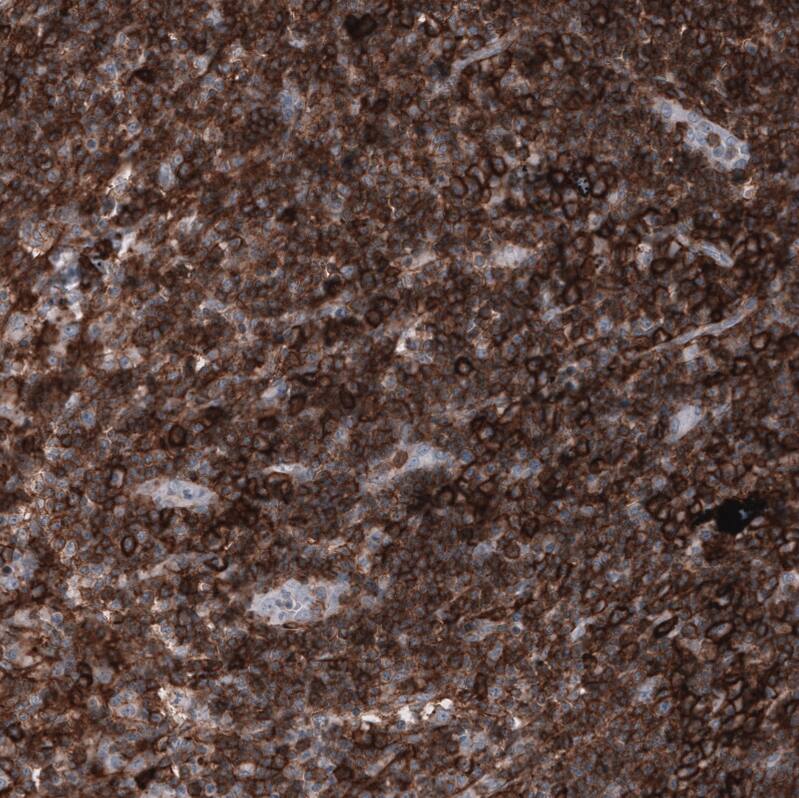 CD44 Antibody (CL13328) - Azide and BSA Free Immunohistochemistry-Paraffin: CD44 Antibody [NBP3-44374]