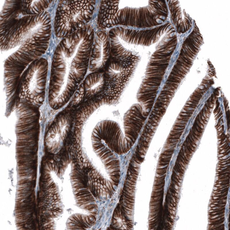 CD44 Antibody (CL13328) - Azide and BSA Free Immunohistochemistry-Paraffin: CD44 Antibody [NBP3-44374]