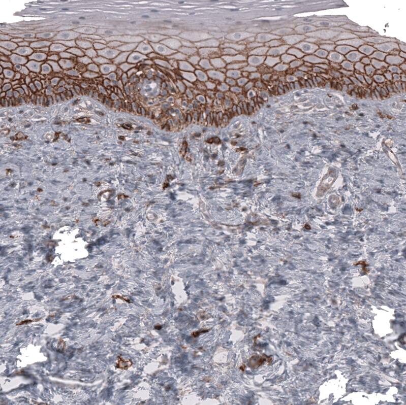 CD44 Antibody (CL13328) - Azide and BSA Free Immunohistochemistry-Paraffin: CD44 Antibody [NBP3-44374]