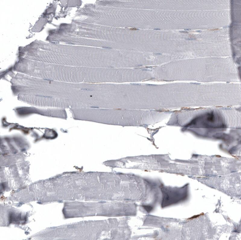 CD44 Antibody (CL13328) - Azide and BSA Free Immunohistochemistry-Paraffin: CD44 Antibody [NBP3-44374]