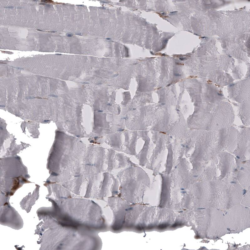 CD44 Antibody (CL13324) - Azide and BSA Free Immunohistochemistry-Paraffin: CD44 Antibody [NBP3-44375]