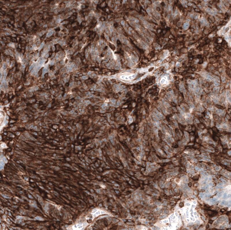 CD44 Antibody (CL13324) - Azide and BSA Free Immunohistochemistry-Paraffin: CD44 Antibody [NBP3-44375]