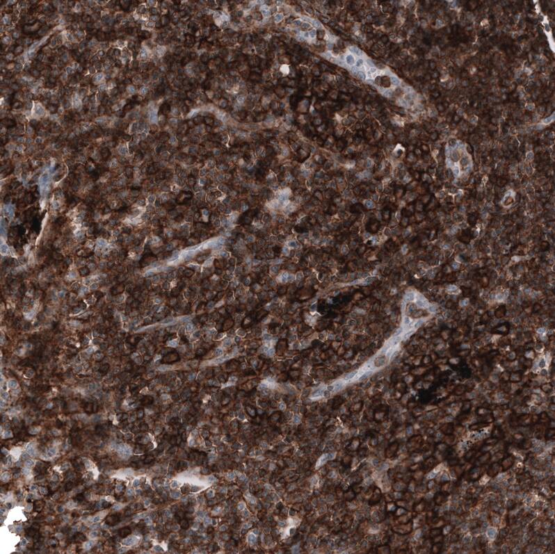 CD44 Antibody (CL13324) - Azide and BSA Free Immunohistochemistry-Paraffin: CD44 Antibody [NBP3-44375]