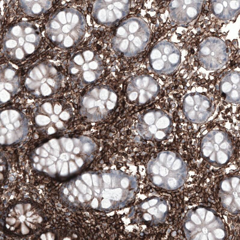 CD44 Antibody (CL13319) - Azide and BSA Free Immunohistochemistry-Paraffin: CD44 Antibody [NBP3-44376]