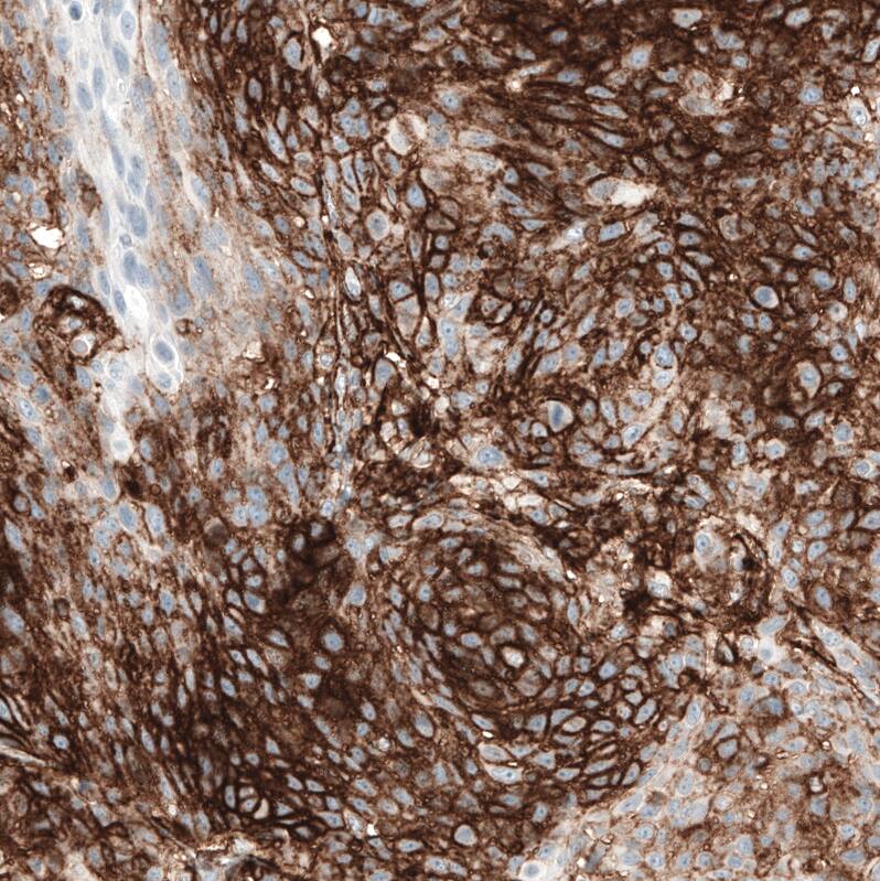 CD44 Antibody (CL13319) - Azide and BSA Free Immunohistochemistry-Paraffin: CD44 Antibody [NBP3-44376]