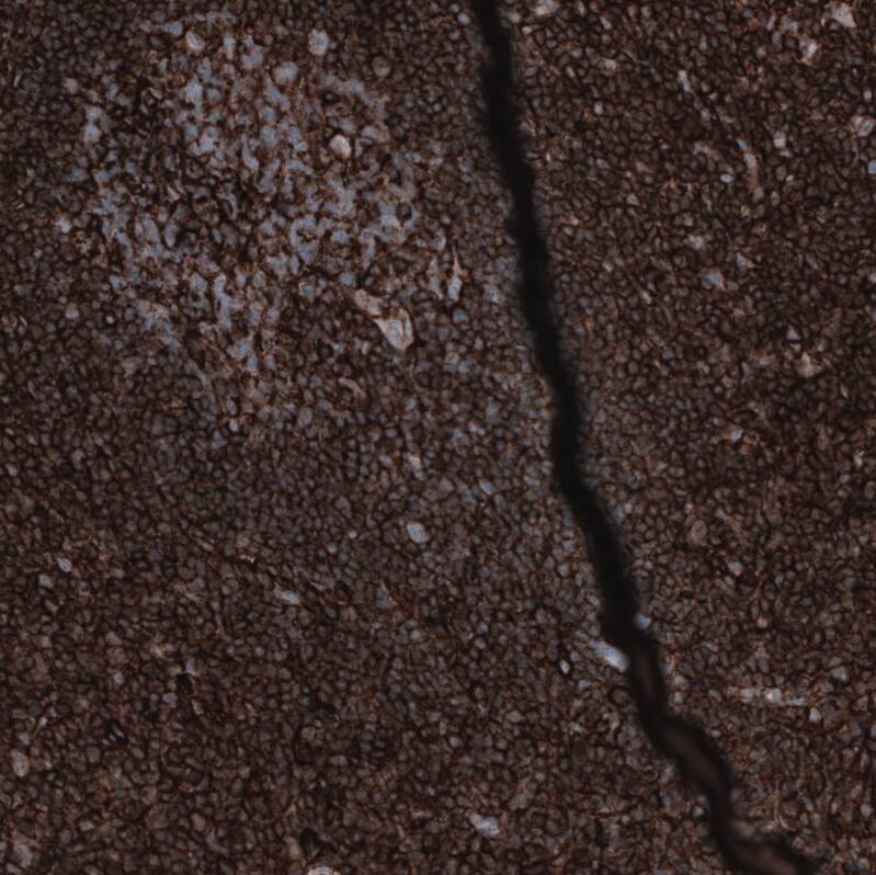 CD44 Antibody (CL13319) - Azide and BSA Free Immunohistochemistry-Paraffin: CD44 Antibody [NBP3-44376]
