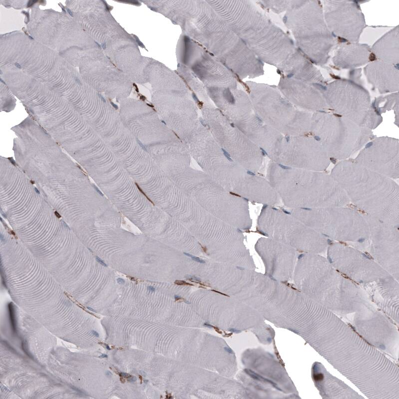 CD44 Antibody (CL13319) - Azide and BSA Free Immunohistochemistry-Paraffin: CD44 Antibody [NBP3-44376]