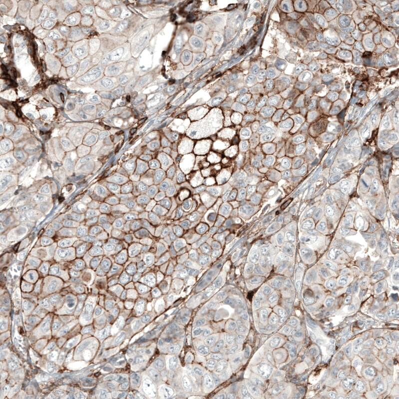 CD44 Antibody (CL13318) - Azide and BSA Free Immunohistochemistry-Paraffin: CD44 Antibody [NBP3-44377]