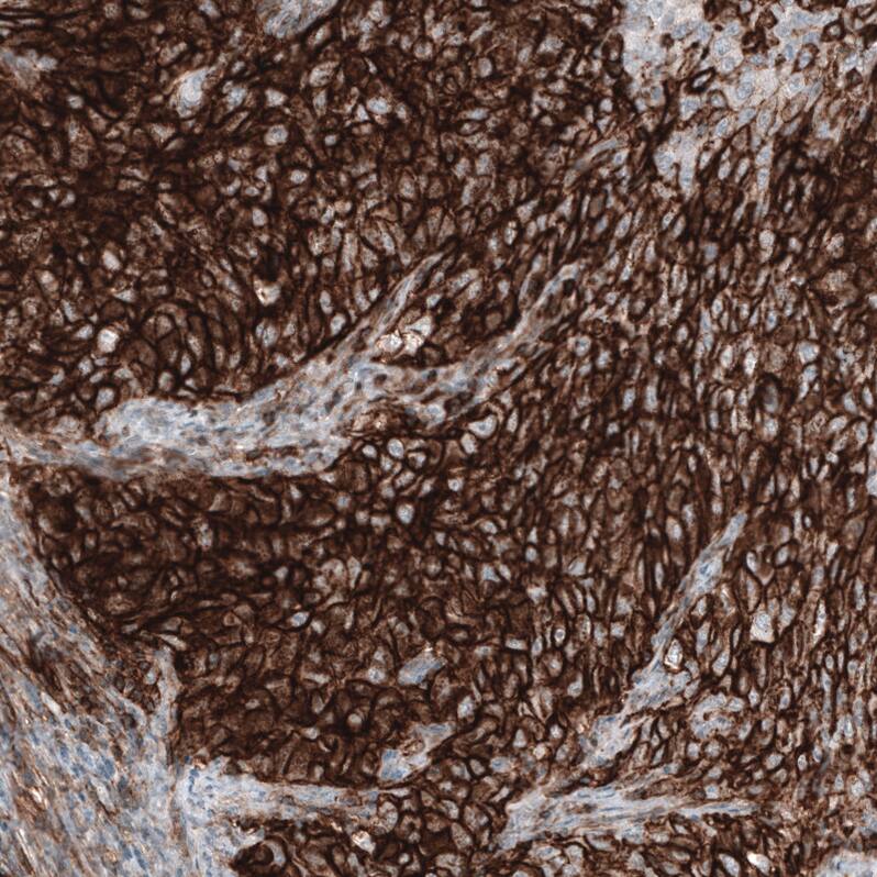 CD44 Antibody (CL13318) - Azide and BSA Free Immunohistochemistry-Paraffin: CD44 Antibody [NBP3-44377]